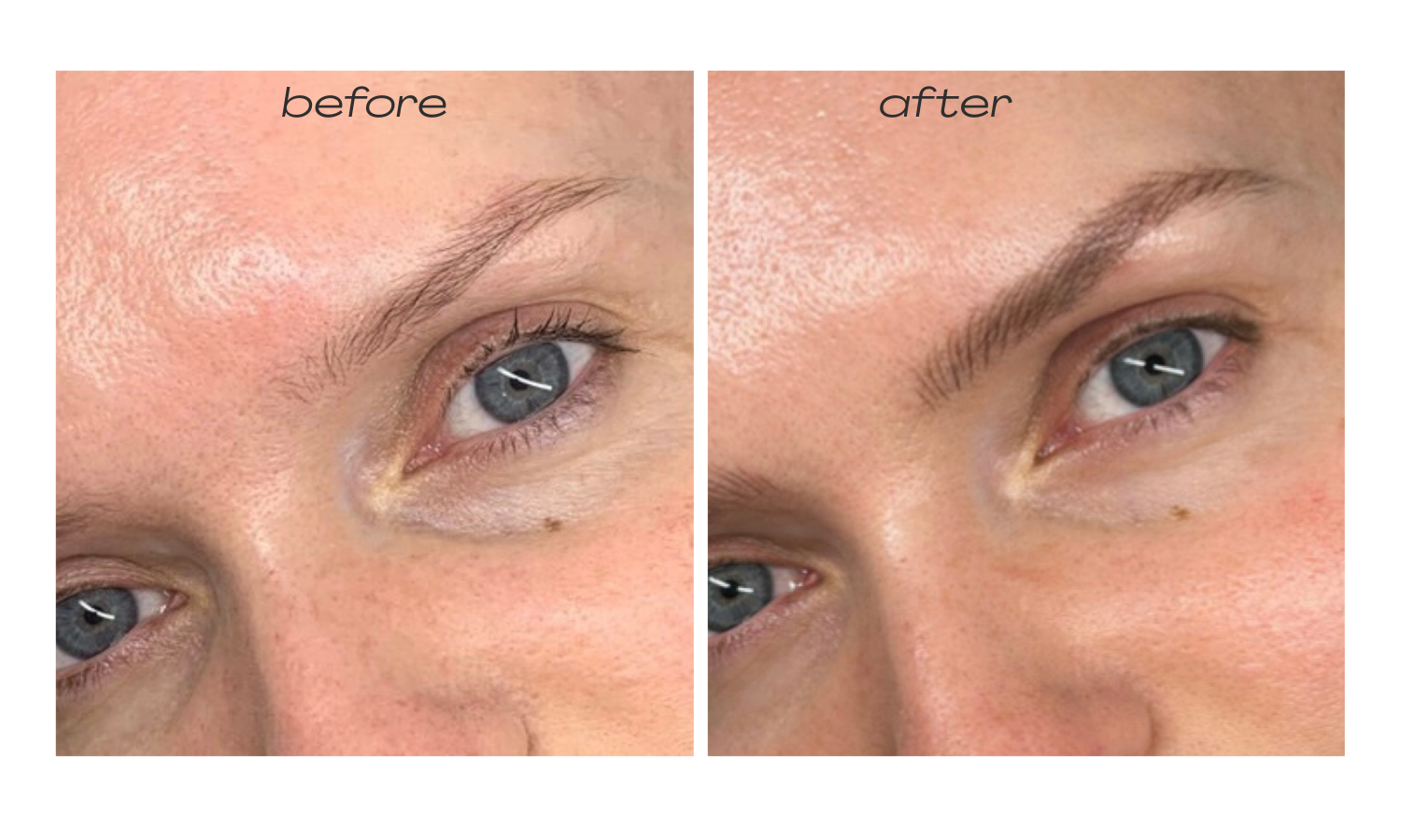 before and after