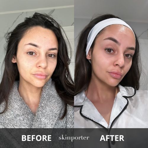 skinporter